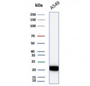 Western blot testing of human A549 cell lysate with IL-18 antibody. Predicted molecular weight ~22 kDa.