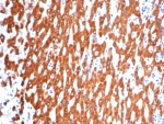 IHC staining of FFPE human liver tissue with IL-18 antibody (clone IL18/4622) at 2ug/ml. HIER: boil tissue sections in pH 9 10mM Tris with 1mM EDTA for 20 min and allow to cool before testing.