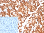 IHC staining of FFPE human pancreas tissue with IL-18 antibody (clone IL18/4624) at 2ug/ml. Inset: PBS used in place of primary Ab (secondary Ab negative control). HIER: boil tissue sections in pH 9 10mM Tris with 1mM EDTA for 20 min and allow to cool before testing.