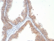 IHC staining of FFPE human prostate tissue with IL-18 antibody (clone IL18/4628) at 2ug/ml. HIER: boil tissue sections in pH 9 10mM Tris with 1mM EDTA for 20 min and allow to cool before testing.