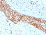 IHC staining of FFPE human colon tissue with CD56 antibody (clone rNCAM1/8655). HIER: boil tissue sections in pH 9 10mM Tris with 1mM EDTA for 20 min and allow to cool before testing.