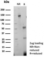 SDS-PAGE analysis of purified, BSA-free recombinant NCAM antibody (clone rNCAM1/8758) as confirmation of integrity and purity.