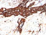 IHC staining of FFPE human colon tissue with recombinant NCAM antibody (clone rNCAM1/8758). HIER: boil tissue sections in pH 9 10mM Tris with 1mM EDTA for 20 min and allow to cool before testing.