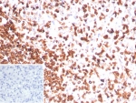 IHC staining of FFPE human spleen tissue with recombinant CD3e antibody (clone rC3e/8881). Inset: PBS used in place of primary Ab (secondary Ab negative control). HIER: boil tissue sections in pH 9 10mM Tris with 1mM EDTA for 20 min and allow to cool before testing.