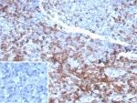 IHC staining of FFPE human lymph node tissue with CD3e antibody (clone rC3e/6967). Inset: PBS used in place of primary Ab (secondary Ab negative control). HIER: boil tissue sections in pH 9 10mM Tris with 1mM EDTA for 20 min and allow to cool before testing.