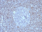 IHC staining of FFPE human lymph node tissue with recombinant FLI1 antibody (clone FLI1/8318R). HIER: boil tissue sections in pH 9 10mM Tris with 1mM EDTA for 20 min and allow to cool before testing.