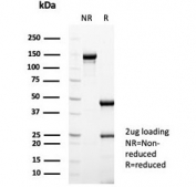 SDS-PAGE analysis of purified, BSA-free NSE gamma antibody (clone ENO2/6680) as confirmation of integrity and purity.