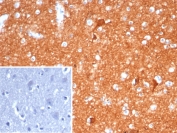 IHC staining of FFPE human brain tissue with NSE gamma antibody (clone ENO2/6680). Inset: PBS used in place of primary Ab (secondary Ab negative control). HIER: boil tissue sections in pH 9 10mM Tris with 1mM EDTA for 20 min and allow to cool before testing.