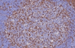 IHC staining of FFPE human tonsil tissue with CD3e antibody (clone C3e/8116R). HIER: boil tissue sections in pH 9 10mM Tris with 1mM EDTA for 20 min and allow to cool before testing.