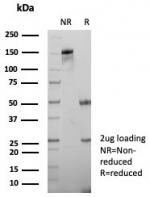SDS-PAGE analysis of purified, BSA-free CD185 antibody (clone CXCR5/8279R) as confirmation of integrity and purity.