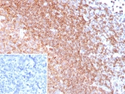 IHC staining of FFPE human tonsil tissue with CD185 antibody (clone CXCR5/8279R). Inset: PBS used in place of primary Ab (secondary Ab negative control). HIER: boil tissue sections in pH 9 10mM Tris with 1mM EDTA for 20 min and allow to cool before testing.