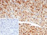 IHC staining of FFPE human spleen tissue with Gamma Enolase antibody (clone ENO2/6678). Inset: PBS used in place of primary Ab (secondary Ab negative control). HIER: boil tissue sections in pH 9 10mM Tris with 1mM EDTA for 20 min and allow to cool before testing.