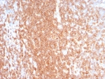IHC staining of FFPE human lymph node tissue with recombinant CD27 antibody (clone LPFS2/8574R). HIER: boil tissue sections in pH 9 10mM Tris with 1mM EDTA for 20 min and allow to cool before testing.