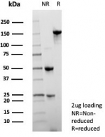 SDS-PAGE analysis of purified, BSA-free NSE gamma antibody (clone ENO2/7447) as confirmation of integrity and purity.