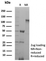 SDS-PAGE analysis of purified, BSA-free CD27 antibody (clone LPFS2/8838R) as confirmation of integrity and purity.