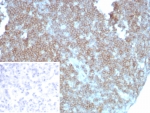 IHC staining of FFPE human lymph node tissue with CD27 antibody (clone LPFS2/8838R). Inset: PBS used in place of primary Ab (secondary Ab negative control). HIER: boil tissue sections in pH 9 10mM Tris with 1mM EDTA for 20 min and allow to cool before testing.