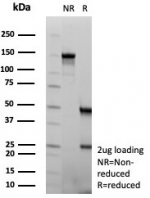 SDS-PAGE analysis of purified, BSA-free ENO2 antibody (clone rENO/8684) as confirmation of integrity and purity.