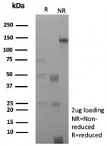 SDS-PAGE analysis of purified, BSA-free CD163 antibody (clone rM130/8823) as confirmation of integrity and purity.