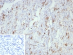 IHC staining of FFPE human tonsil tissue with CD163 antibody (clone rM130/8823). Inset: PBS used in place of primary Ab (secondary Ab negative control). HIER: boil tissue sections in pH 9 10mM Tris with 1mM EDTA for 20 min and allow to cool before testing.
