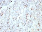 IHC staining of FFPE human tonsil tissue with CD163 antibody (clone rM130/8823). HIER: boil tissue sections in pH 9 10mM Tris with 1mM EDTA for 20 min and allow to cool before testing.