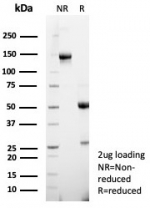 SDS-PAGE analysis of purified, BSA-free NSE gamma antibody (clone ENO/8253R) as confirmation of integrity and purity.