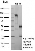 SDS-PAGE analysis of purified, BSA-free NSE gamma antibody (clone ENO/8614R) as confirmation of integrity and purity.
