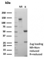 SDS-PAGE analysis of purified, BSA-free NSE Gamma antibody (clone ENO/8632R) as confirmation of integrity and purity.