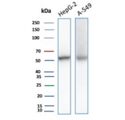 Western blot testing of human HepG2 and A549 cell lysate with NSE Gamma antibody (clone ENO/8632R). Predicted molecular weight ~47 kDa.