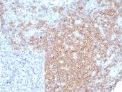IHC staining of FFPE human lymph node tissue with CD27 antibody (clone LPFS2/8316R). Inset: PBS used in place of primary Ab (secondary Ab negative control). HIER: boil tissue sections in pH 9 10mM Tris with 1mM EDTA for 20 min and allow to cool before testing.