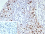 IHC staining of FFPE human tonsil tissue with CD163 antibody (clone M130/8822R). Inset: PBS used in place of primary Ab (secondary Ab negative control). HIER: boil tissue sections in pH 9 10mM Tris with 1mM EDTA for 20 min and allow to cool before testing.