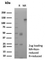 SDS-PAGE analysis of purified, BSA-free CD163 antibody (clone rM130/8820) as confirmation of integrity and purity.