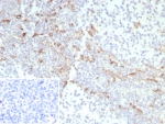 IHC staining of FFPE human tonsil tissue with CD163 antibody (clone rM130/8820). Inset: PBS used in place of primary Ab (secondary Ab negative control). HIER: boil tissue sections in pH 9 10mM Tris with 1mM EDTA for 20 min and allow to cool before testing.