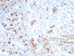 IHC staining of FFPE human tonsil tissue with recombinant CD163 antibody (clone M130/8821R). HIER: boil tissue sections in pH 9 10mM Tris with 1mM EDTA for 20 min and allow to cool before testing.