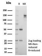 SDS-PAGE analysis of purified, BSA-free A2M antibody (clone A2M/4847) as confirmation of integrity and purity.