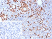 IHC staining of FFPE human tonsil tissue with CD9 antibody (clone CD9/7417). Inset: PBS used in place of primary Ab (secondary Ab negative control). HIER: boil tissue sections in pH 9 10mM Tris with 1mM EDTA for 20 min and allow to cool before testing.