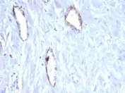 IHC staining of FFPE human uterus tissue with vWF antibody (clone VWF/4105). HIER: boil tissue sections in pH 9 10mM Tris with 1mM EDTA for 20 min and allow to cool before testing.