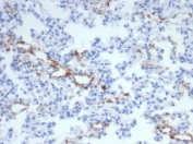 IHC staining of FFPE rat lung with vWF antibody (clone VWF/4105). HIER: boil tissue sections in pH 9 10mM Tris with 1mM EDTA for 20 min and allow to cool before testing.