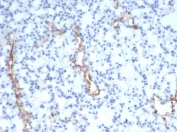 IHC staining of FFPE mouse lung with vWF antibody (clone VWF/4105). HIER: boil tissue sections in pH 9 10mM Tris with 1mM EDTA for 20 min and allow to cool before testing.