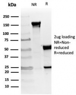 SDS-PAGE analysis of purified, BSA-free vWF antibody (clone VWF/4105) as confirmation of integrity and purity.