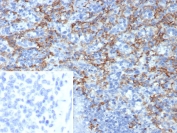 IHC staining of FFPE human spleen tissue with CD163L1 antibody (clone CD163L1/7974). Inset: PBS used in place of primary Ab (secondary Ab negative control). HIER: boil tissue sections in pH 9 10mM Tris with 1mM EDTA for 20 min and allow to cool before testing.