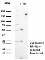 SDS-PAGE analysis of purified, BSA-free Fibroblast Growth Factor 23 antibody (clone FGF23/132) as confirmation of integrity and purity.