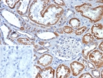 IHC staining of FFPE human kidney tissue with Fibroblast Growth Factor 23 antibody at 2ug/ml. Inset: PBS used in place of primary Ab (secondary Ab negative control). HIER: boil tissue sections in pH 9 10mM Tris with 1mM EDTA for 20 min and allow to cool before testing.