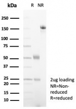 SDS-PAGE analysis of purified, BSA-free Alpha-2-Macroglobulin antibody (clone A2M/4848) as confirmation of integrity and purity.