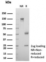 SDS-PAGE analysis of purified, BSA-free Alpha-2-Macroglobulin antibody (clone A2M/4849) as confirmation of integrity and purity.