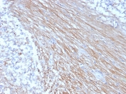 IHC staining of FFPE human placental tissue with CD303 antibody (clone CLEC4C/3400). HIER: boil tissue sections in pH 9 10mM Tris with 1mM EDTA for 20 min and allow to cool before testing.