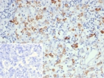 IHC staining of FFPE human lymph node tissue with CD163L1 antibody (clone CD163L1/7971). Inset: PBS used in place of primary Ab (secondary Ab negative control). HIER: boil tissue sections in pH 9 10mM Tris with 1mM EDTA for 20 min and allow to cool before testing.