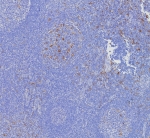 IHC staining of FFPE human tonsil tissue with CD163L1 antibody (clone CD163L1/7972). HIER: boil tissue sections in pH 9 10mM Tris with 1mM EDTA for 20 min and allow to cool before testing.