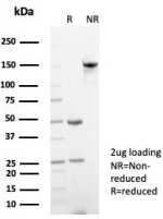 SDS-PAGE analysis of purified, BSA-free Alpha-2-Macroglobulin antibody (clone A2M/6550) as confirmation of integrity and purity.