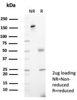 SDS-PAGE analysis of purified, BSA-free Alpha-2-Macroglobulin antibody (clone A2M/6555) as confirmation of integrity and purity.