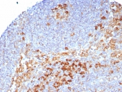 IHC staining of FFPE human lymph node tissue with CD9 antibody (clone CD9/7416). HIER: boil tissue sections in pH 9 10mM Tris with 1mM EDTA for 20 min and allow to cool before testing.